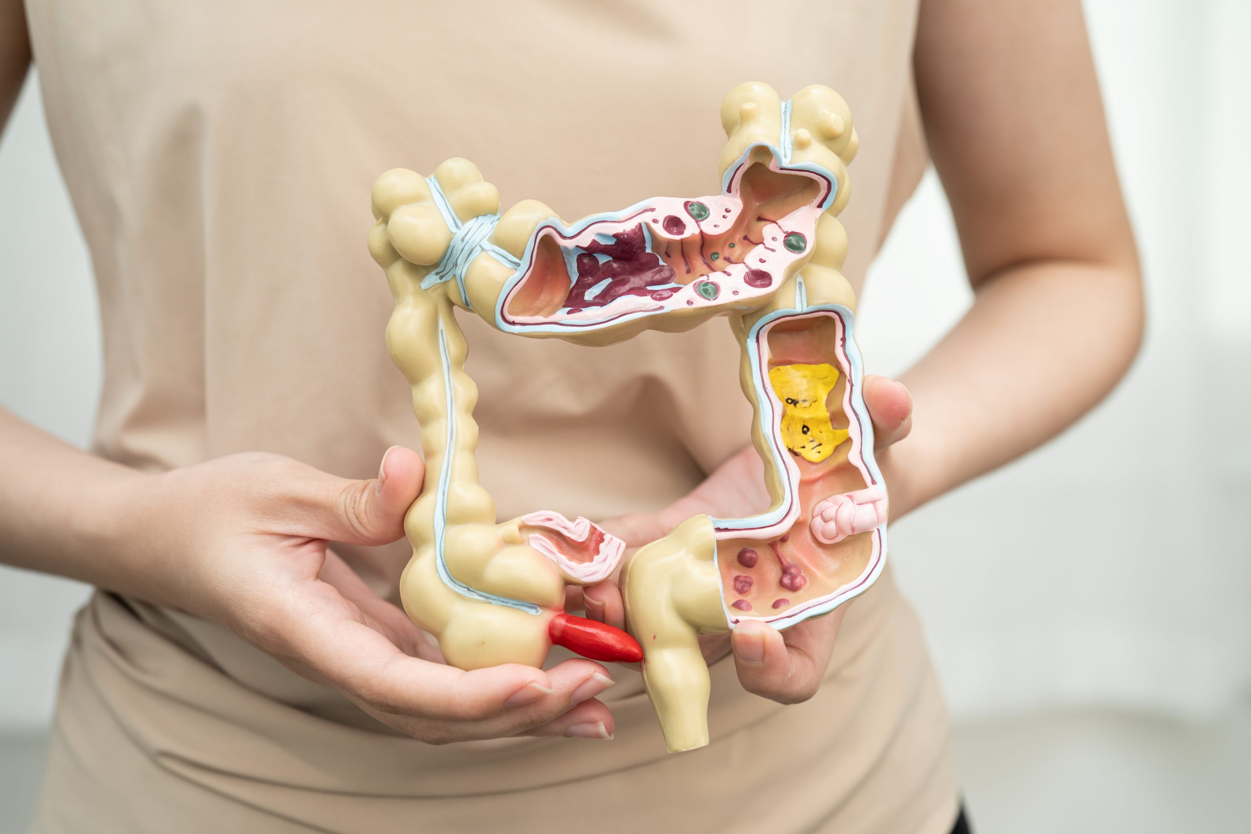 Salud Gastrointestinal